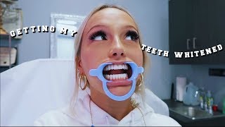 Getting my teeth whitened for the first time…