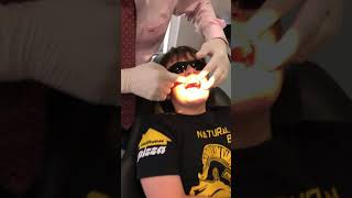 Phase I Interceptive Orthodontic Treatment 2×4 Mechanics