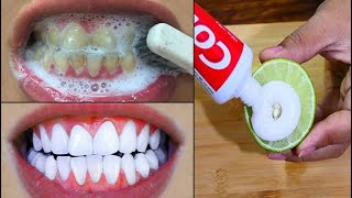 3 Minutes Colgate & Lime Teeth Whitening | Homemade Teeth Whitening