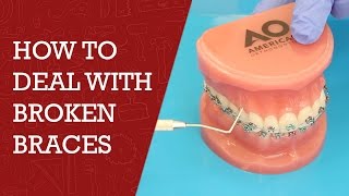 How to Fix Broken Braces | Orthodontics Tips #braces #orthodonics