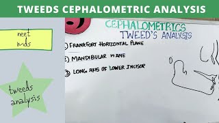 tweeds cephalometric analysis  – orthodontics lecture notes