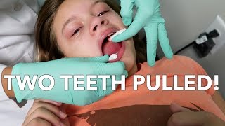 THE ORTHODONTIST PULLED HER TEETH!!!