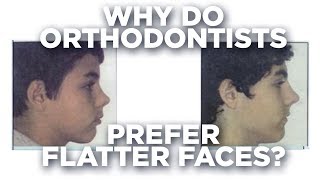 Why do orthodontists prefer flatter faces?