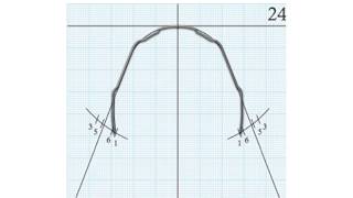 Ortodontia – Edgewise-  Arco Superior Dobras de 1ª Ordem  / Orthodontic Edgewise – 1º Order Bends