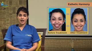 Introduction to Orthodontics-Learn the basics