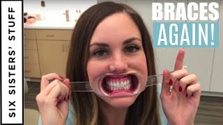 ADULT BRACES vs. INVISALIGN – My Orthodontist Consultation