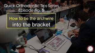 figure-8 O tie and ligature tie, episode no.6 , Quick orthodontic tips