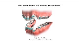 Do Orthodontists Still Need To Extract Teeth?