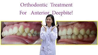 Orthodontic Treatment For Anterior Deepbite!