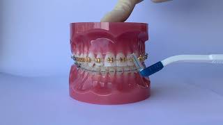 INTERDENTAL BRUSHING SHEFFIELD ORTHODONTICS