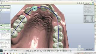 3Shape Orthodontics 2010 Video