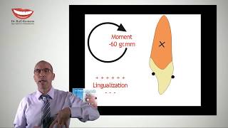 Dr. Rafi Romano – Lingual orthodontics biomechanics  1- center of resistance