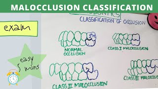 malocclusion of teeth I orthodontics lecture