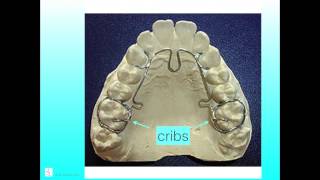 Introduction to ALF Orthodontics