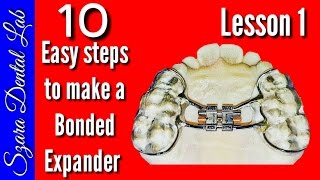 How to make a Orthodontic Bonded palatal expander