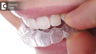 Duration of Orthodontic Treatment using Invisible Braces – Dr Girish P V