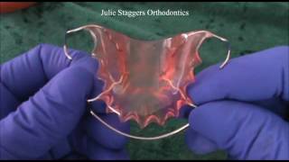 Care of Orthodontic Retainers