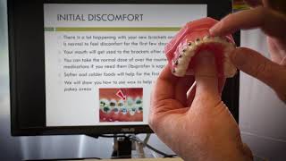 Stoll Orthodontics | Starting Braces! | Orthodontist North Denver Metro, CO