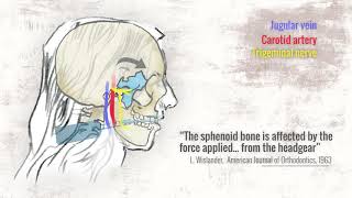 All About Orthodontic Headgear