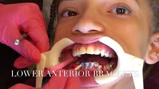 Orthodontic Technician/ Dental assistant Vlog