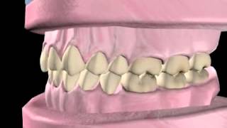 What is Orthodontics?