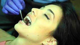 Incognito Lingual Braces | Orthodontist Pensacola FL