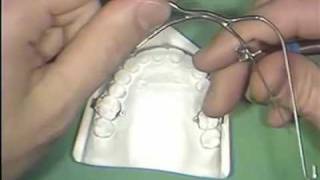 Orthodontic Facebow Construction