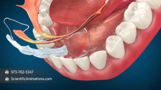 Orthodontic Procedures – Minor Tooth Movement