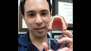 Lingual Braces Tutorial | InBrace Tutorial | Dr. Robert Passamano, Orthodontist