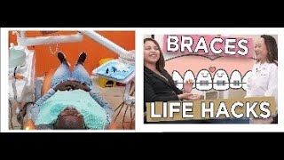 I Started My Braces Journey || Transforming Smiles With Technology At Lake Basin Orthodontics KE