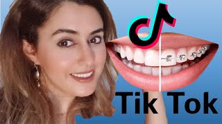 Orthodontist Reacts to Braces Off Tik Tok's!