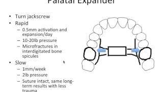 Orthodontic Treatment Pt. 3