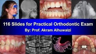 Practical Orthodontic Exam with Answers