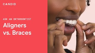 Ask An Orthodontist: Clear Aligners vs. Braces