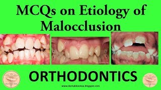 MCQs in Orthodontics – Etiology of Malocclusion – Dentosphere