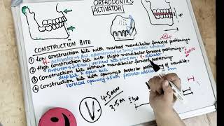 activator in orthodontics lecture I part 2