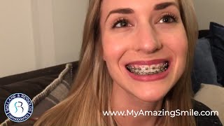 Orthodontic Consultation Photos at Home – Braces – Invisalign – Spillane & Reynolds Orthodontics