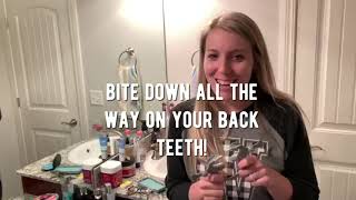 Whitlock Orthodontics | How To: ScanBox! | Whitlock-On-The-Go Virtual | Springdale, AR Orthodontist