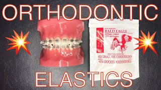 Orthodontic Elastics