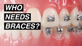 Is Orthodontic Treatment Necessary?