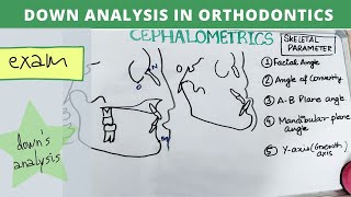 downs analysis orthodontics – dental lectures