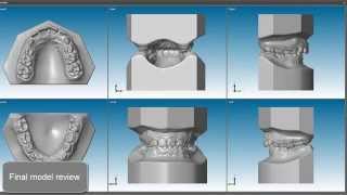 DWOS Orthodontic Archiving