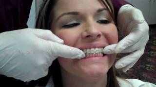 Abari Orthodontics HAwley retainer delivery by Dr. WIll