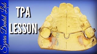 How to make a Transpalatal Arch TPA Orthodontic appliance by Szara