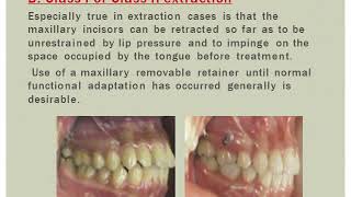 Retention in orthodontics – Part 1