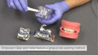 American Orthodontics Empower Self Ligating Braces Opening and Closing – Product Manager Video