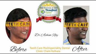 Best Dental Braces Clinic in Kolkata | Best Orthodontist in Kolkata | Best Cosmetic Dentist Kolkata