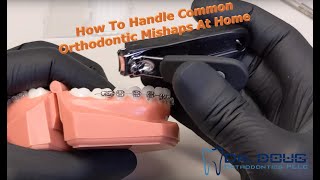 How to handle orthodontic emergencies at home