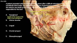 Nerve injuries associated with difficult mandibular wisdom tooth extraction